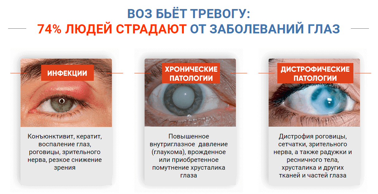 Заболевания глаз